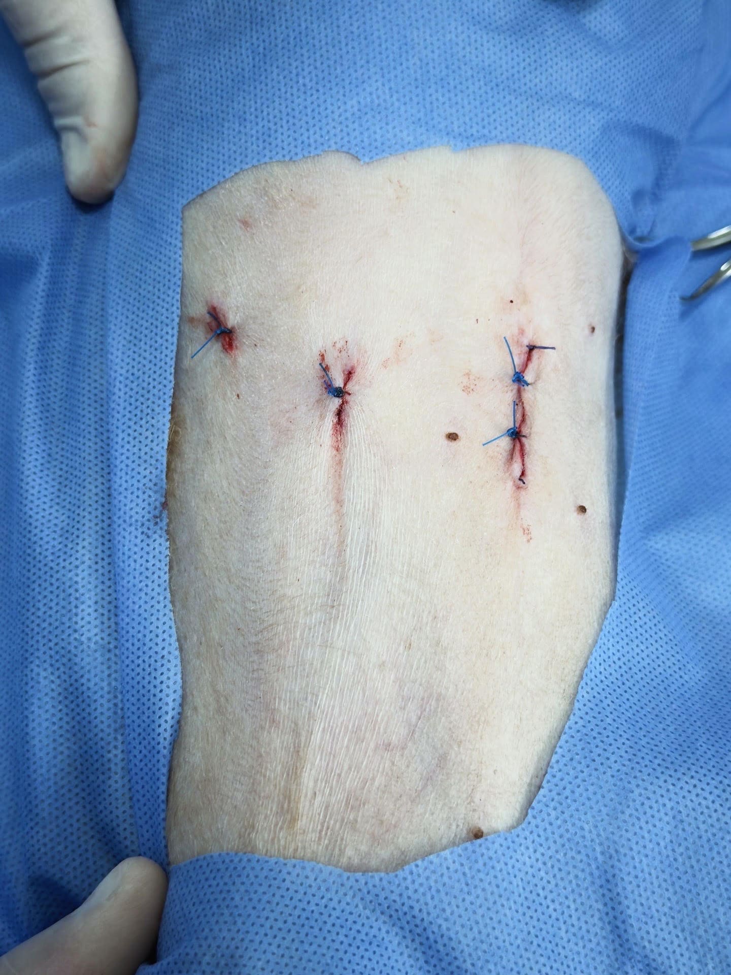 Endoscopía en curso