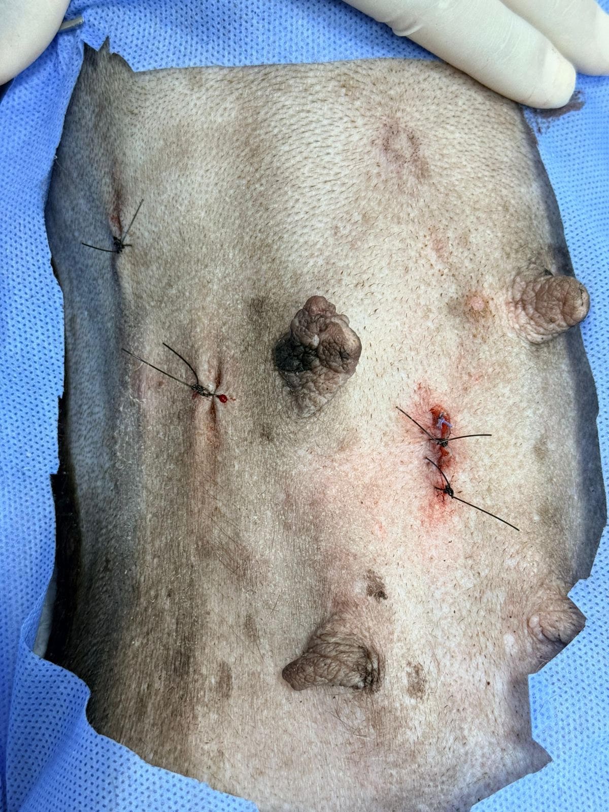 Procedimiento endoscópico