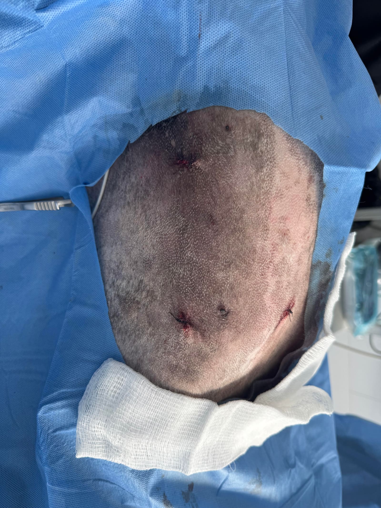 Recuperación post operatoria